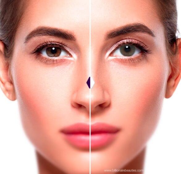 Before and after transformation using Solotica Hidrocor Rio Búzios green contact lenses on dark brown eyes.