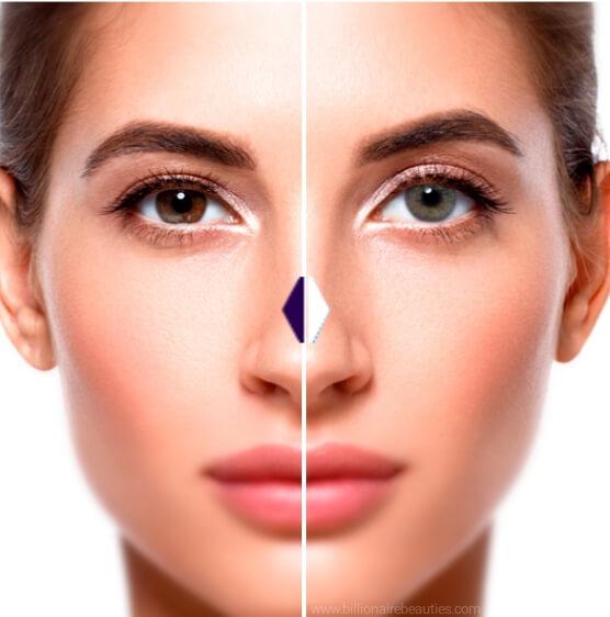Before and after transformation using Solotica Hidrocor Rio Ipanema green contact lenses on dark brown eyes.